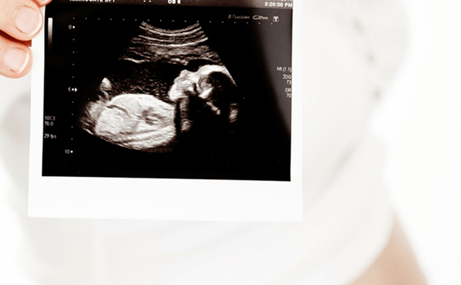妊娠初期の赤ちゃんの成長と妊婦の便秘対策